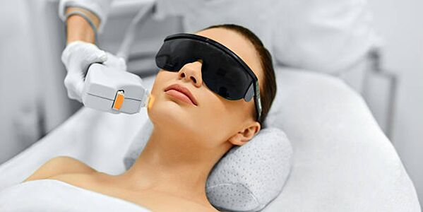 Prosedur laser untuk peremajaan kulit
